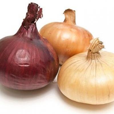 Onion Trio Pack, 3 lbs